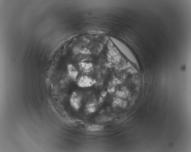 X0000116120359201001040955