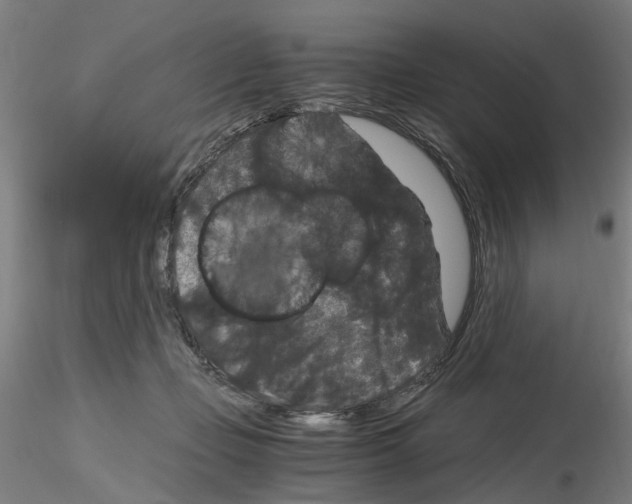 X0000116120365201001040955
