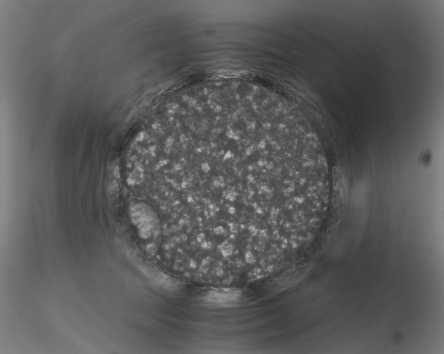 X0000116120369201001040955