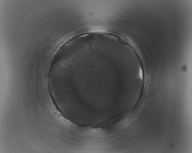 X0000116120385201001040955