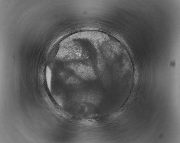 X0000116120386201001040955