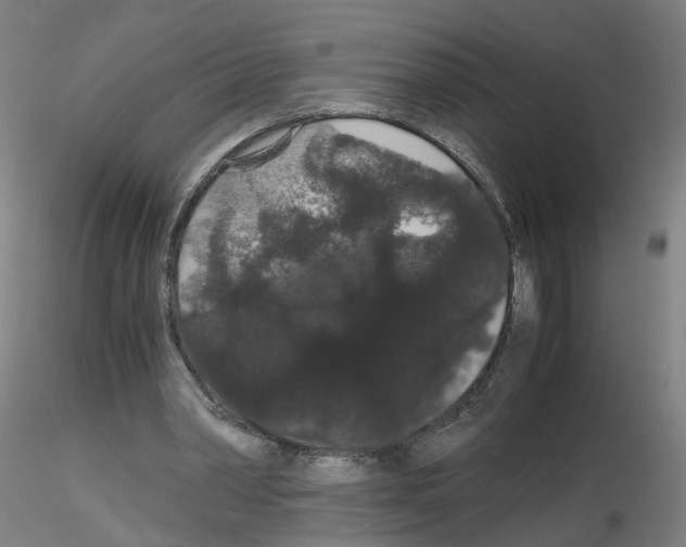 X0000116120390201001040955