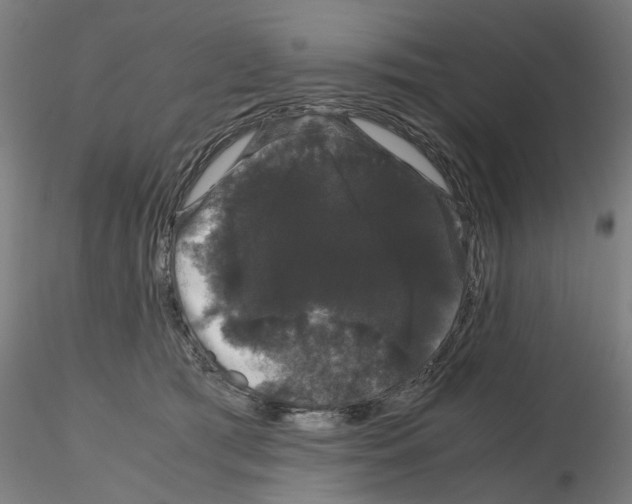 X0000116120417201001040954