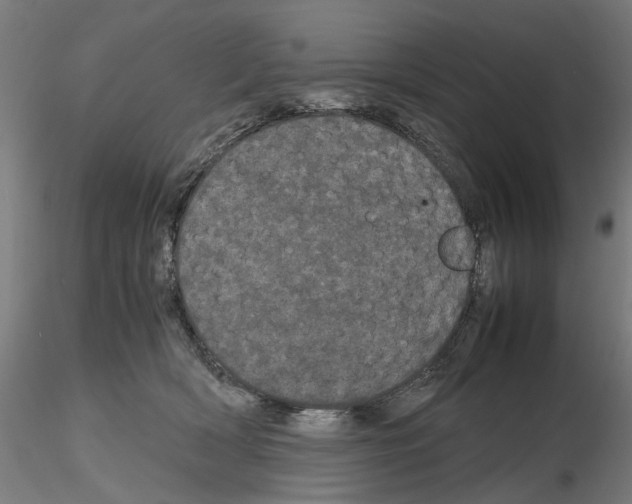 X0000116120418201001040954