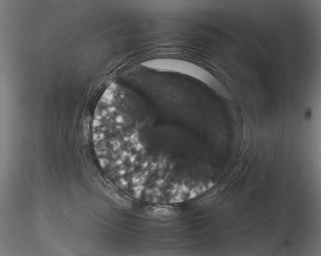 X0000116120475201001040954