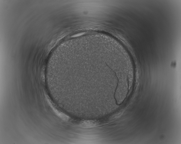 X0000116120489201001040953