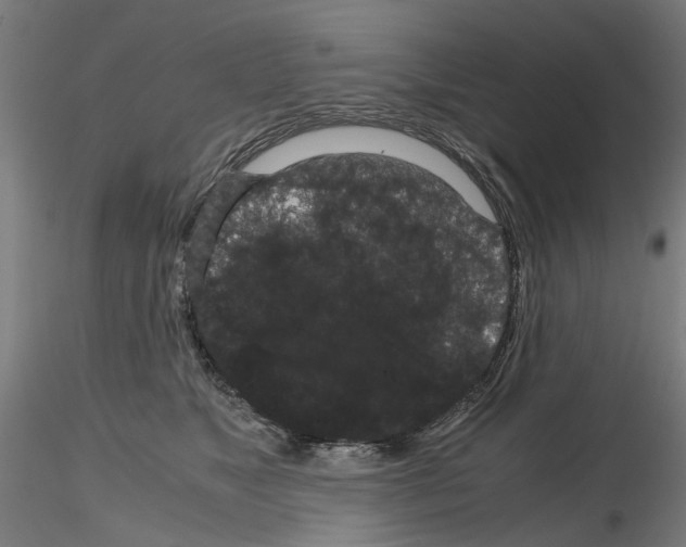 X0000116120517201001040953