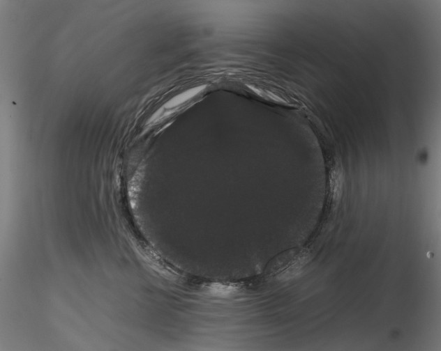 X0000116120570201001040953