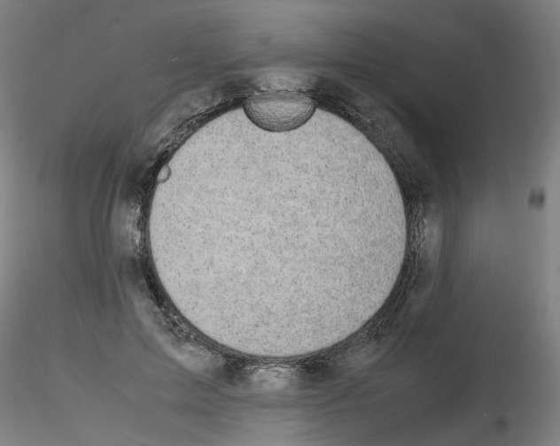 X0000116120599201001040952