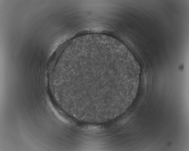 X0000116120638201001040951