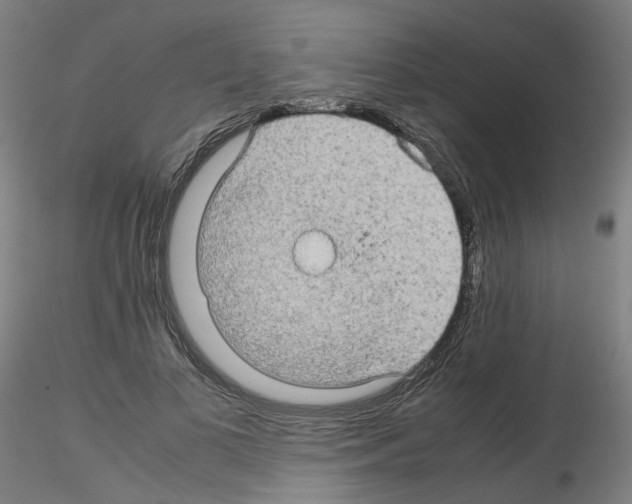 X0000116120693201001040951