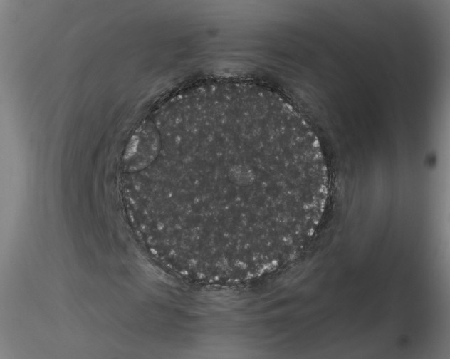 X0000116120817201001040948