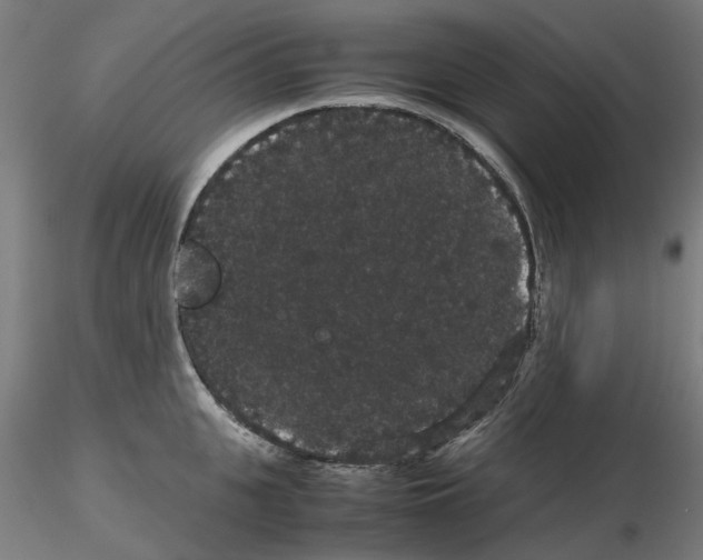 X0000116120951201001040947
