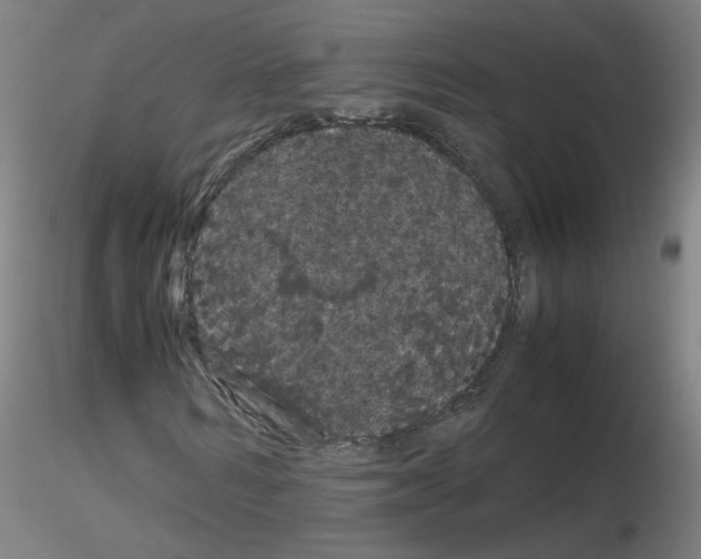 X0000116120962201001040947