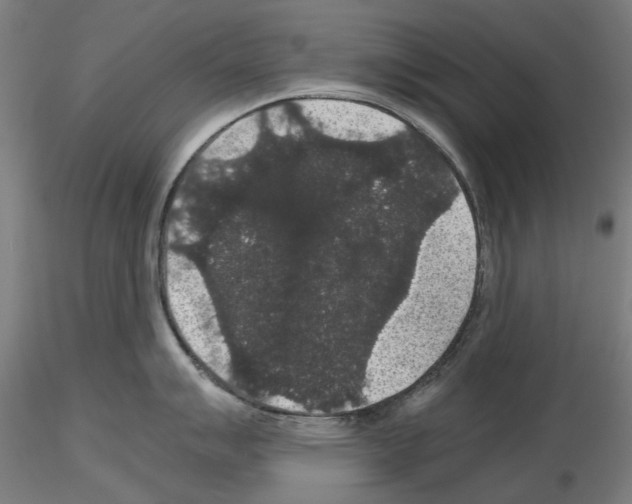 X0000116121007201001040946