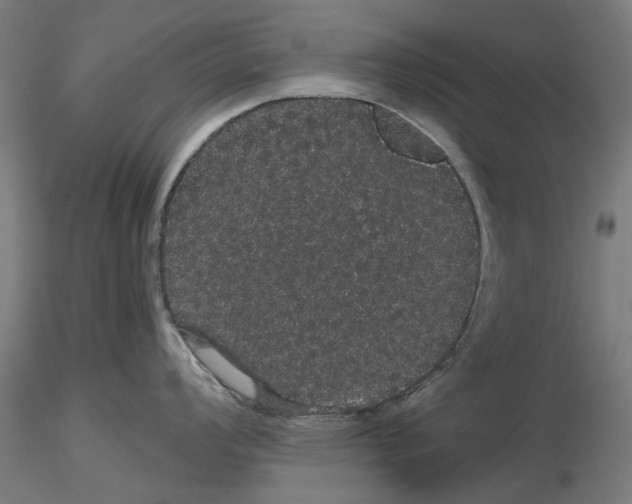 X0000116121008201001040946