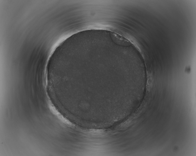 X0000116121080201001040945