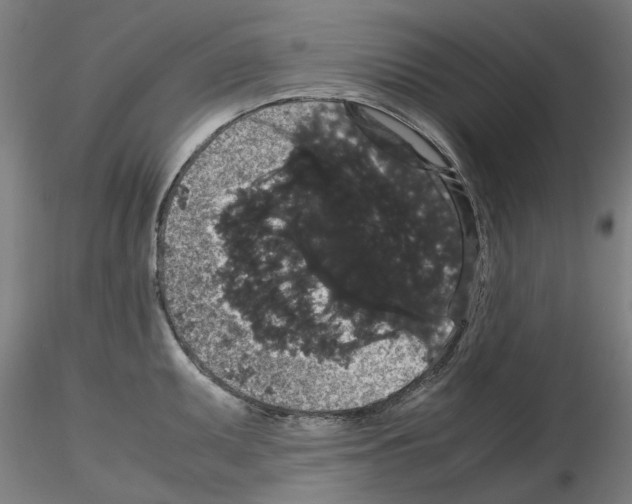 X0000116121095201001040945