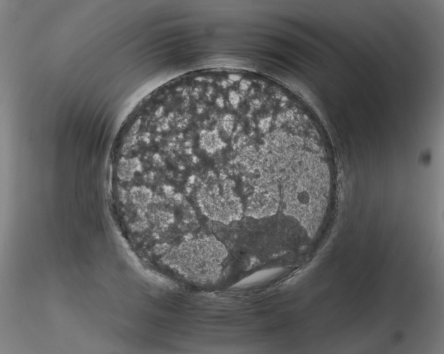 X0000116121125201001040945