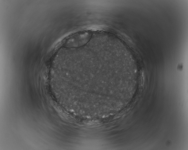 X0000116121158201001040944