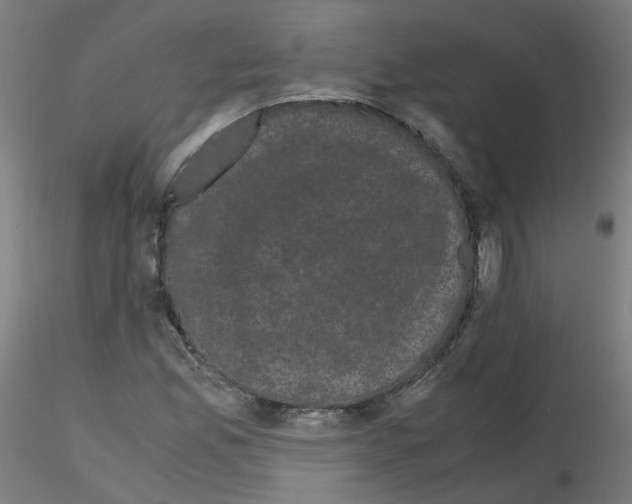 X0000116121165201001040944