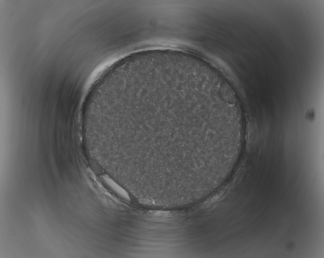X0000116121172201001040944