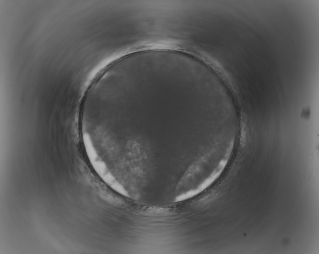 X0000116121174201001040944