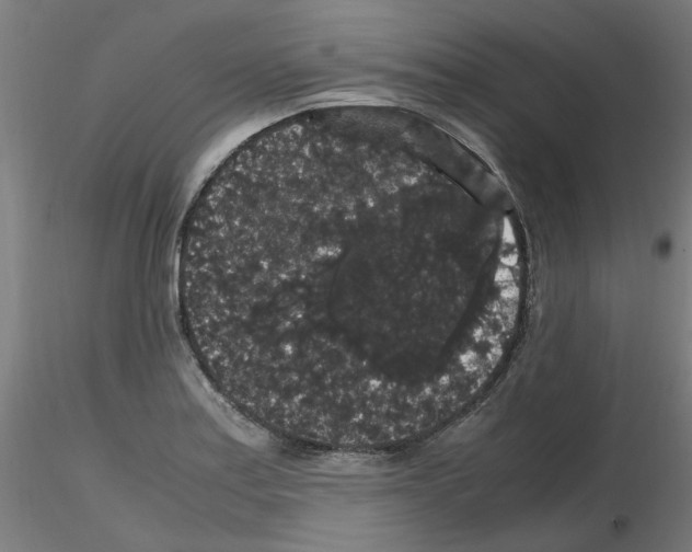X0000116121179201001040944