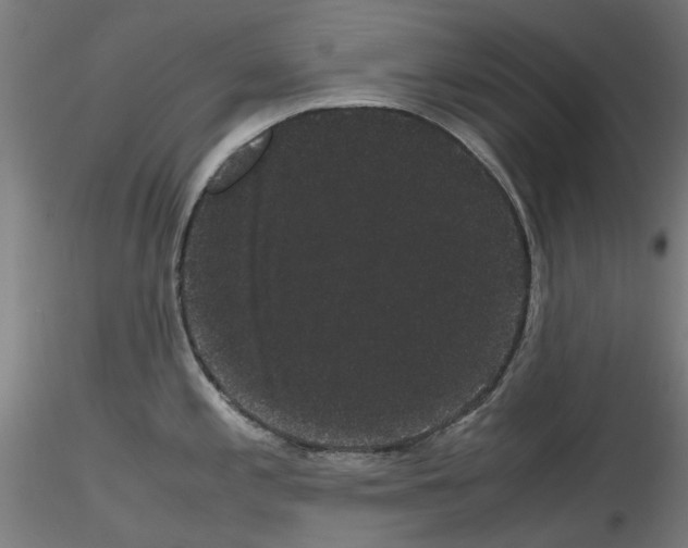 X0000116121197201001040944