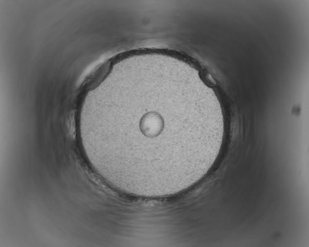 X0000116121262201001040943