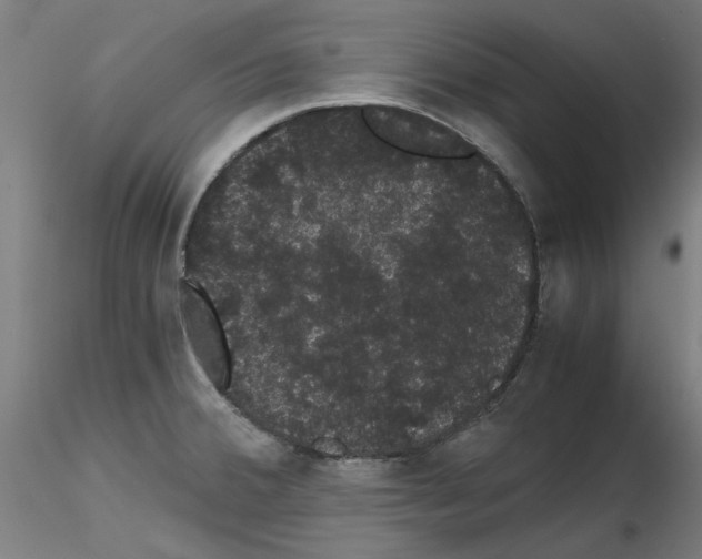 X0000116121380201001040941