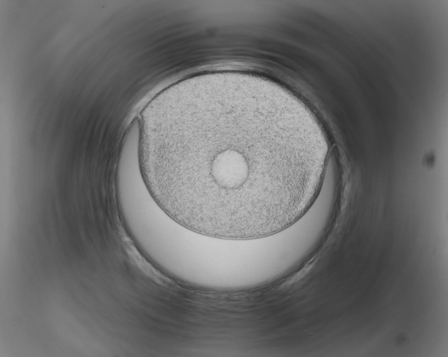 X0000116121417201001040941