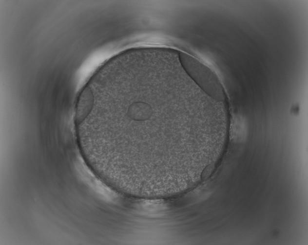 X0000116121464201001040940