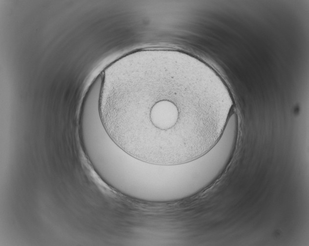 X0000116121485201001040940