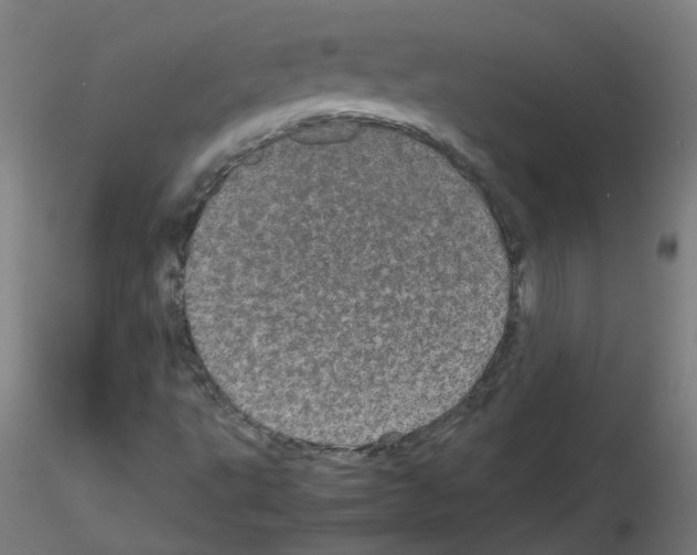 X0000116121495201001040939