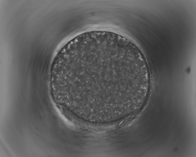 X0000116121525201001040940
