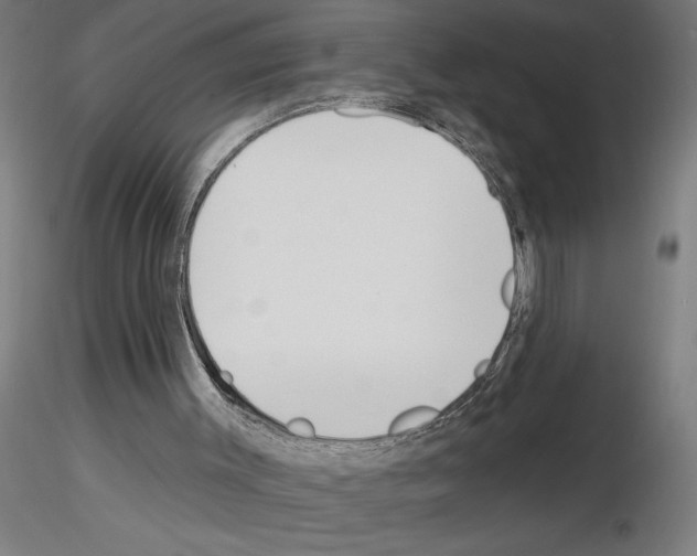 X0000116130003201001041021