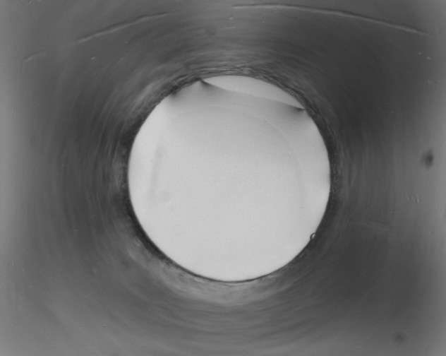 X0000116130035201001041021
