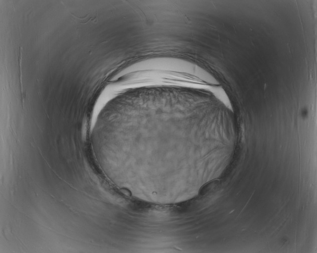 X0000116130076201001041020