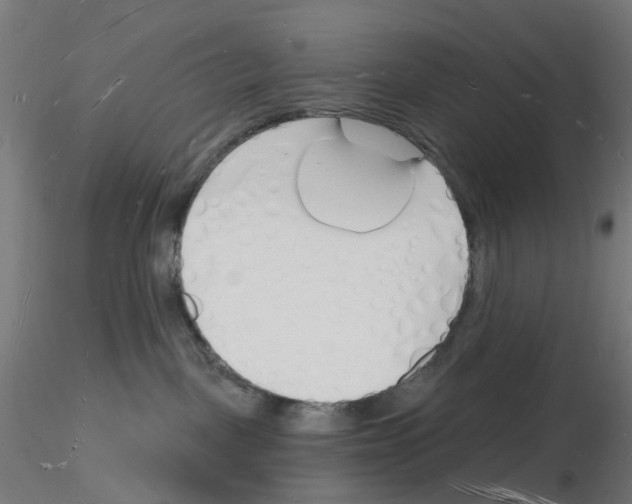 X0000116130093201001041020