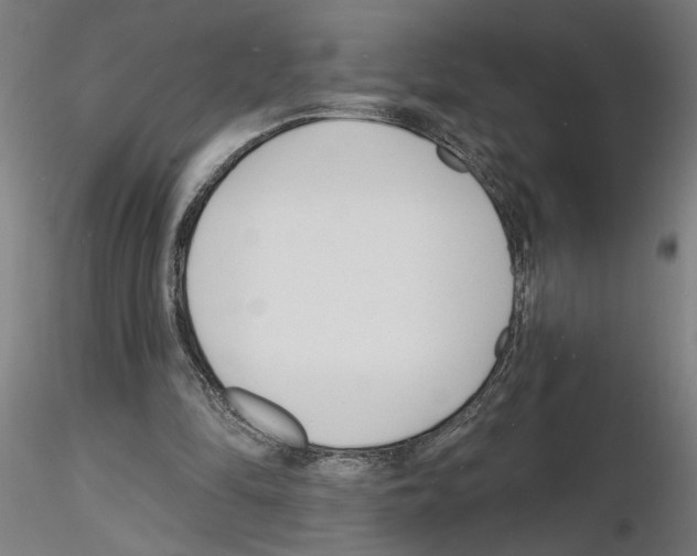 X0000116130294201001041017