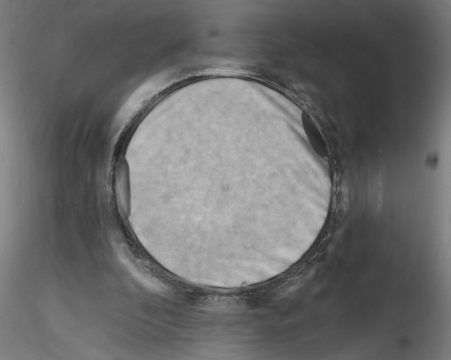 X0000116130296201001041017