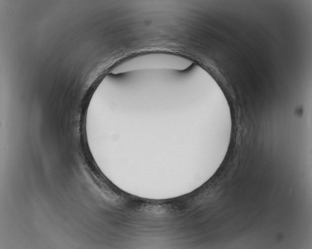X0000116130299201001041017