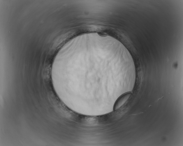 X0000116130325201001041017