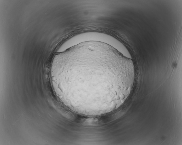 X0000116130366201001041016