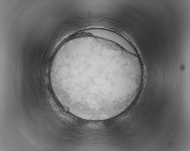 X0000116130386201001041016