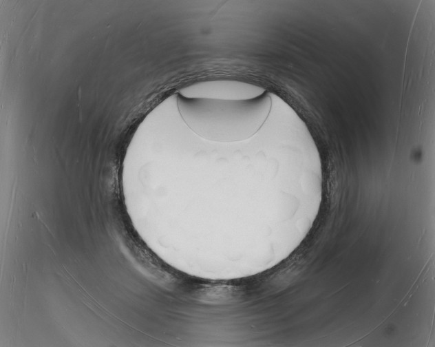 X0000116130459201001041015