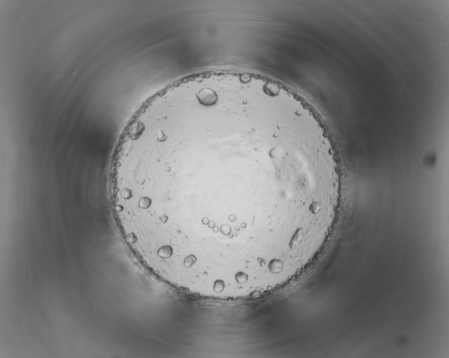 X0000116130856201001041010