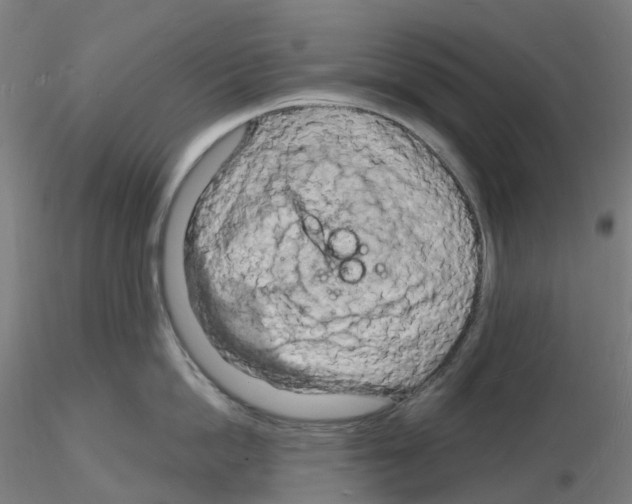 X0000116130862201001041010