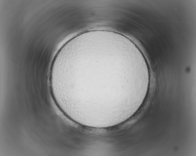X0000116130957201001041009